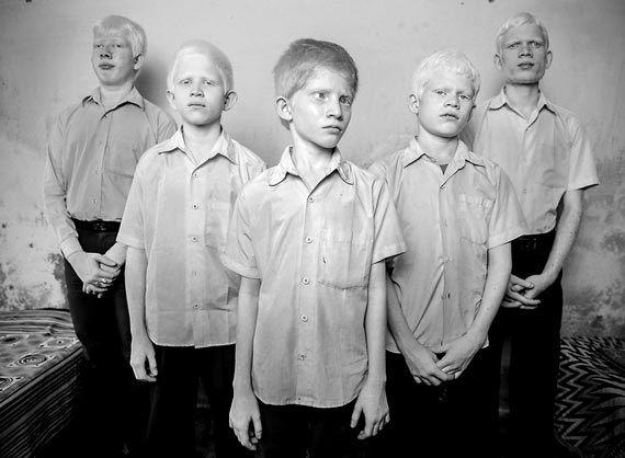 Брент Стиртон, ЮАР, занял первое место в категории «Портреты» с фотографией группы слепых мальчиков-альбиносов в интернате в Вивекананде, Западная Бенгалия